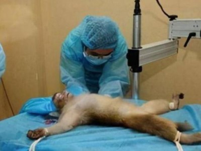 脑袋换人后的生活变化（探寻换脑手术的影响及其社会反响）